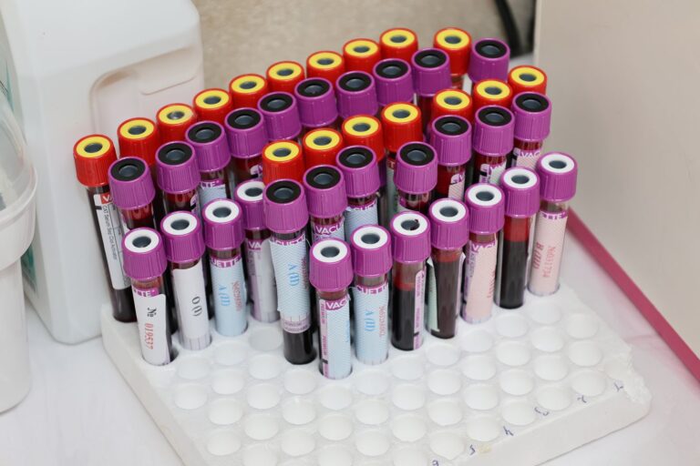 Rangée de tubes de prélèvement sanguin dans un laboratoire, prêts pour analyse